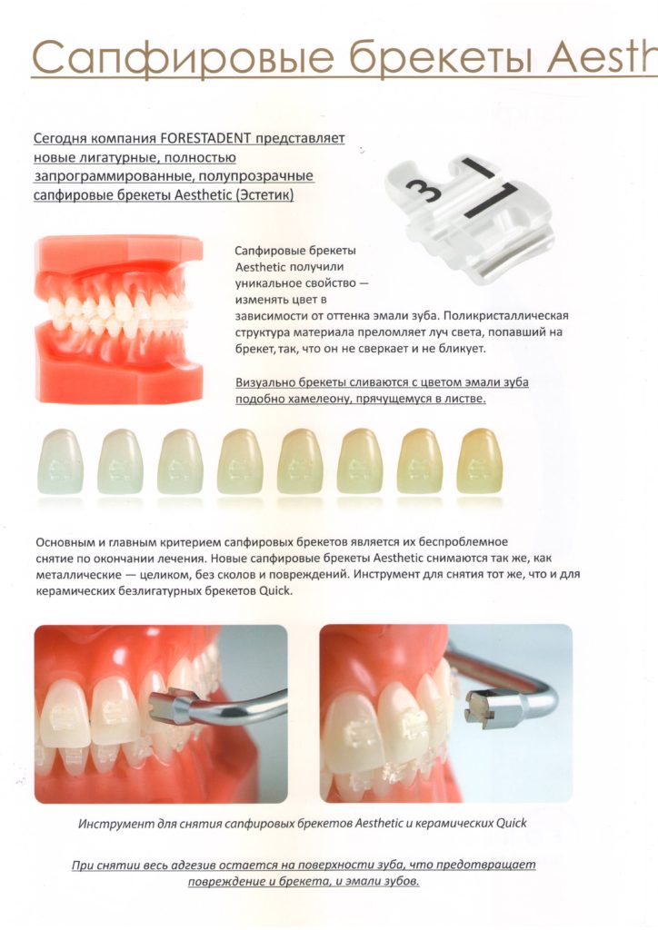 Ортодонтия – красивые зубы, голливудская улыбка