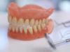 Что делать, если зубной протез не держится во рту 